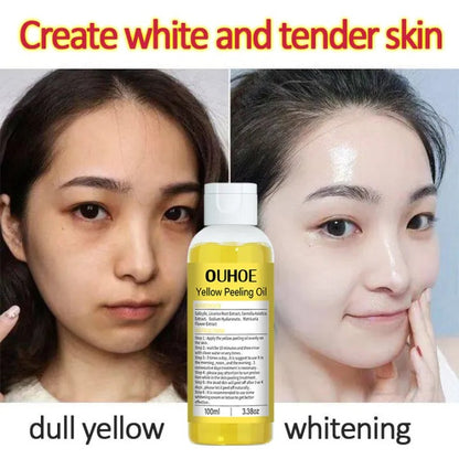 Reveal Radiant Skin — Yellow Peel Oil Treatment 🍋
