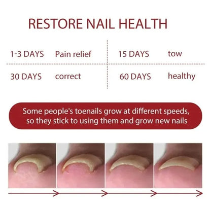 Relief Nail Oil – Extra Strength Care for Discolored & Damaged Nails