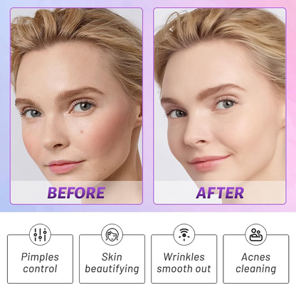 Portable High Frequency Facial Electric Skin Care & Scalp Massage