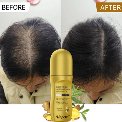 Unpree Biotin Regrowth Roll-On Hair Treatment