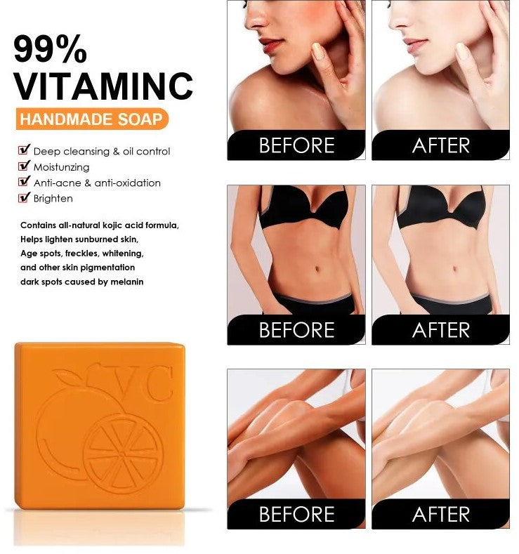 Vitamin C Brightening Soap